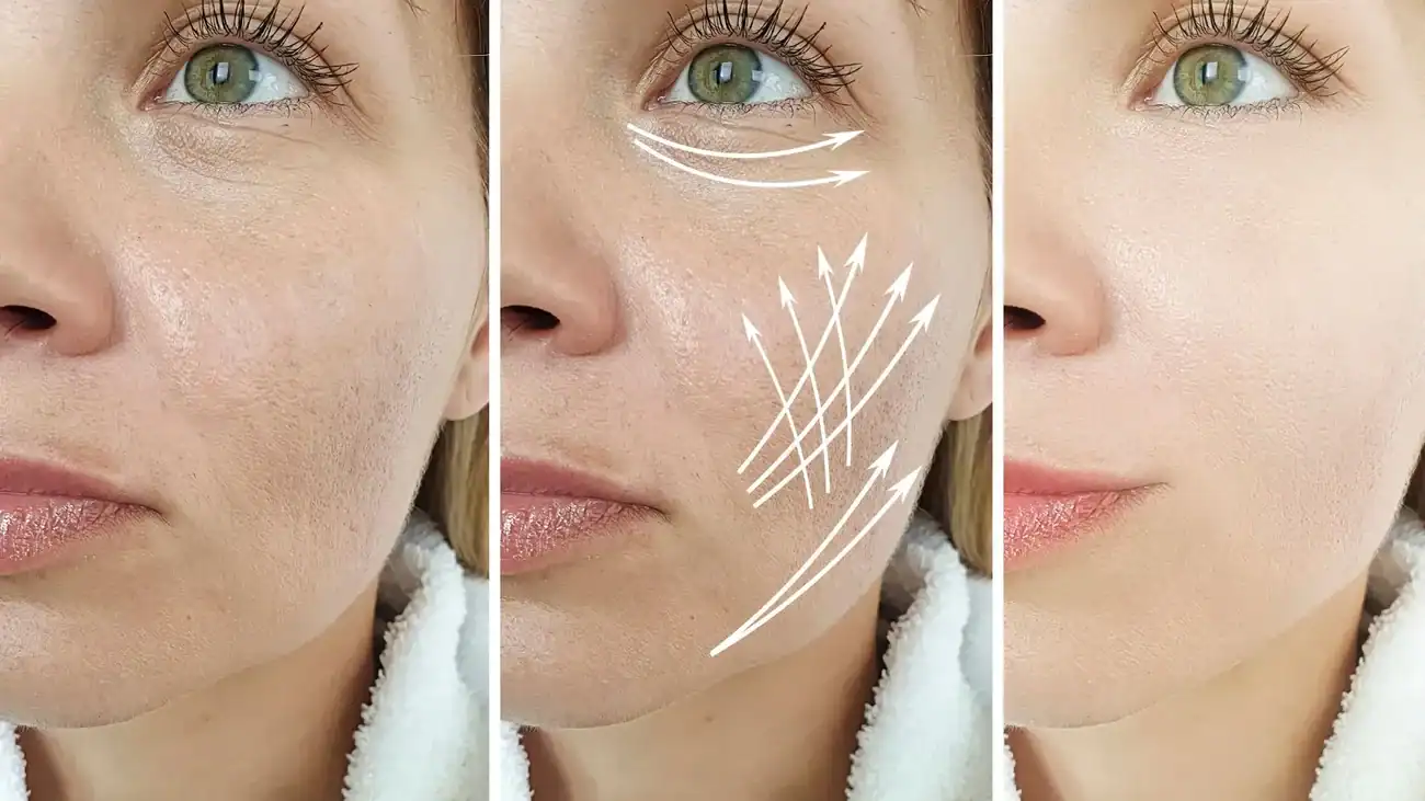Can One Treatment Really Tackle More Than One Skin Concern Cheshire?