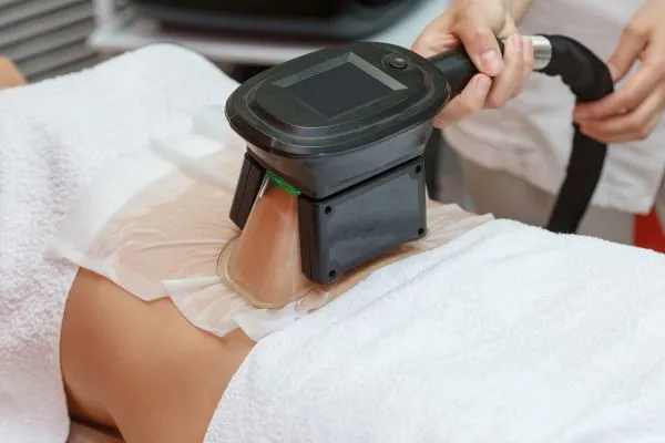 Image of person having fat freezing treatment to help weight gain Cheshire