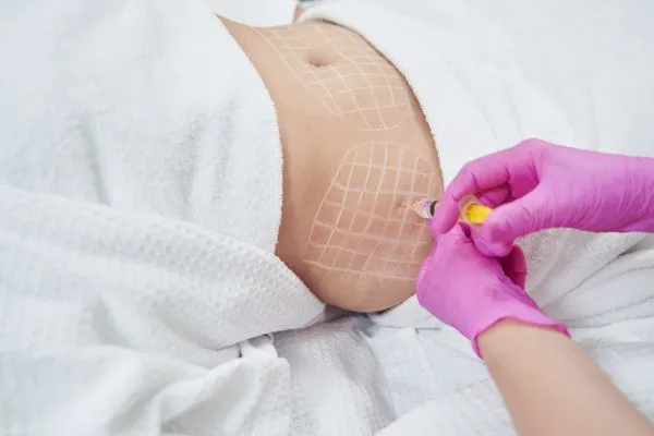 image of fat dissolving injections on love handles to help combat weight gain Cheshire