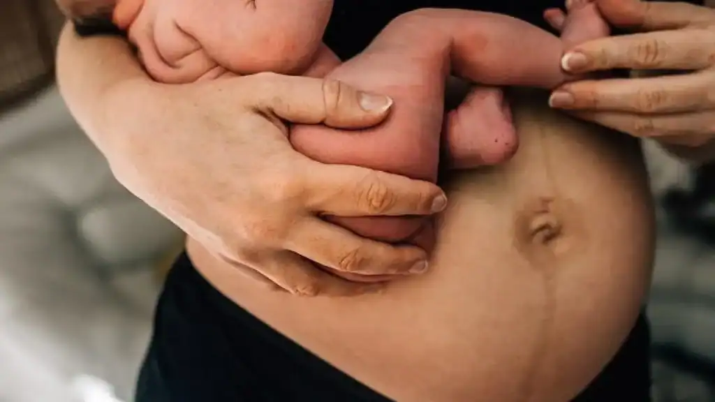 Why Is My Stomach Still Big After Pregnancy Cheshire?